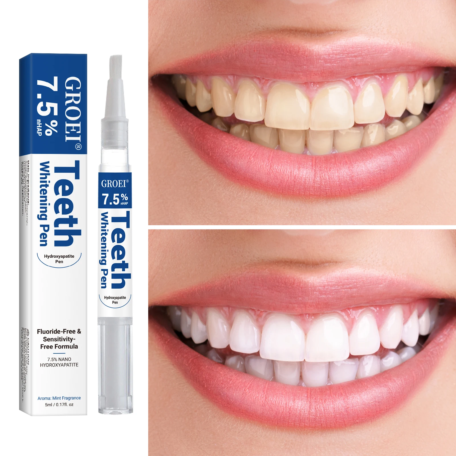 Hydroxyapatite Tooth Whitening - Teeth Whitening Before And After recension och pris