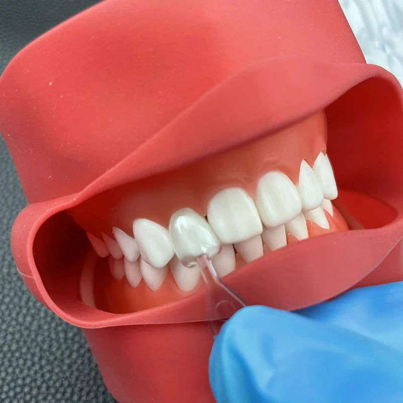 1Set/3Set/5Set Dental Veneer M - Teeth Whitening Moulds recension och pris