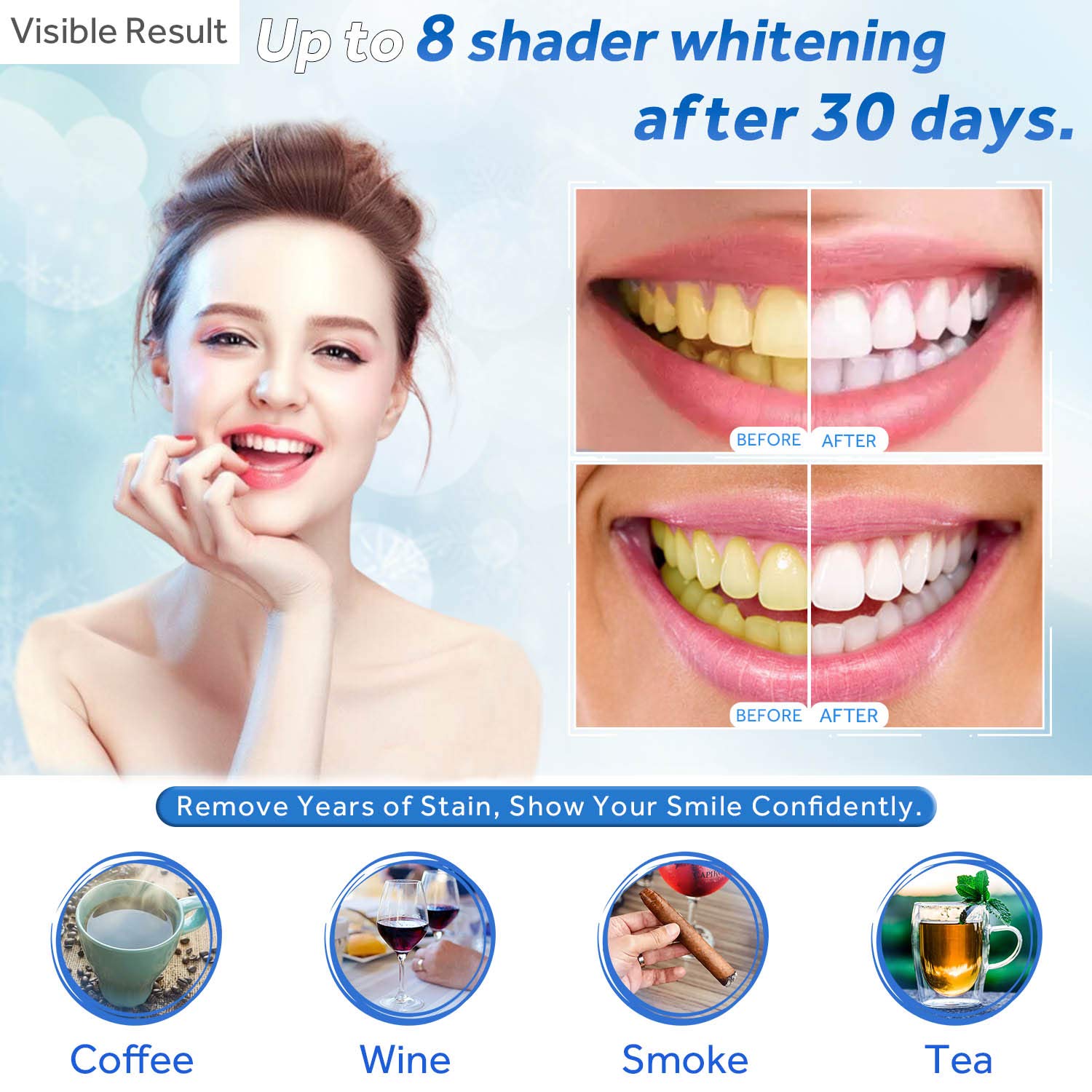 Teeth Whitening Gel Refill Syr - Teeth Whitening Before And After recension och pris