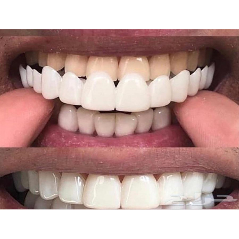 Soft Silicone Gel Dental Oral  - Teeth Whitening Moulds recension och pris