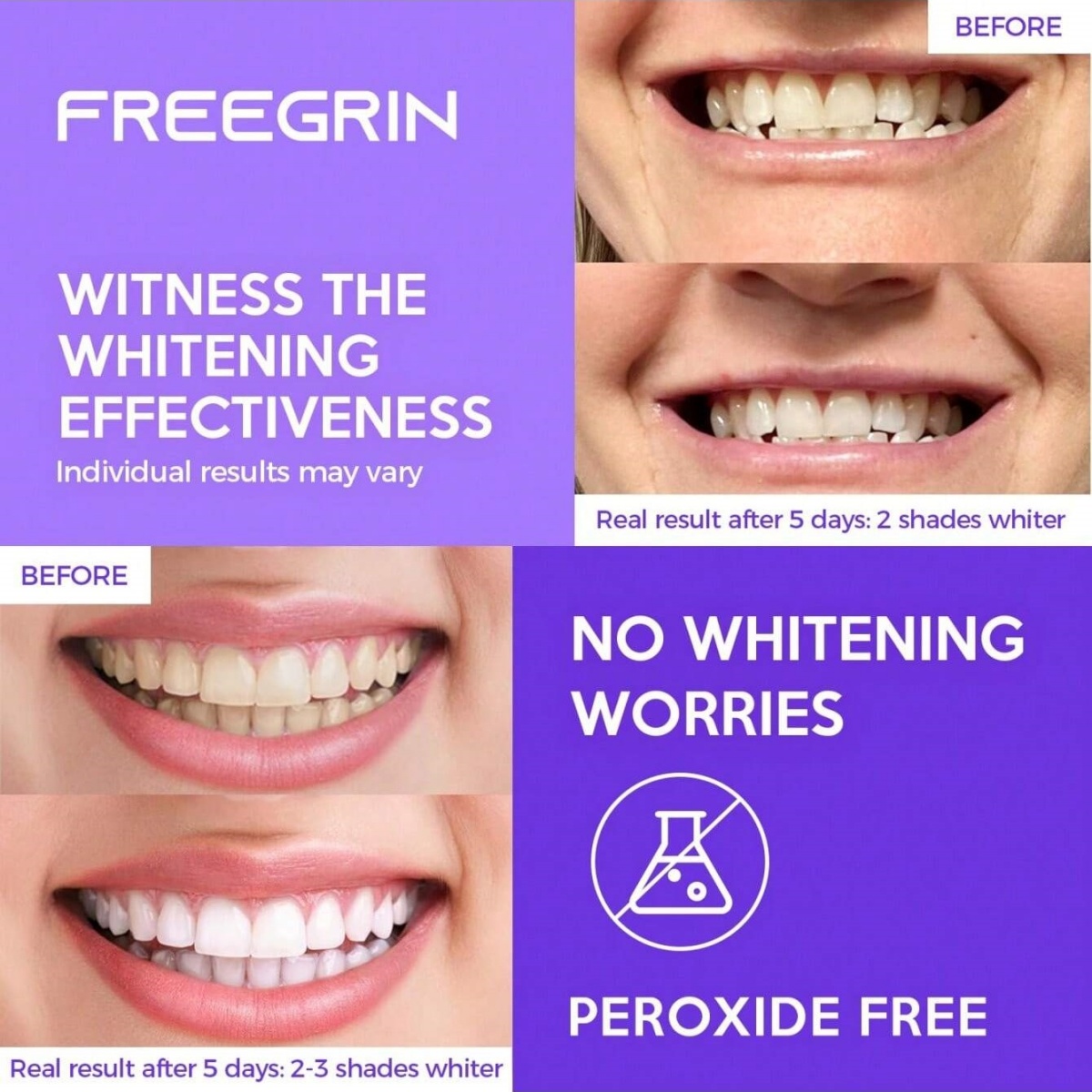 Deluxe Whitening Teeth Sticker - Teeth Whitening Before And After recension och pris